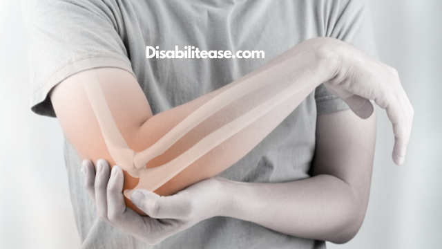 What Are The Causes Of Bone Spurs