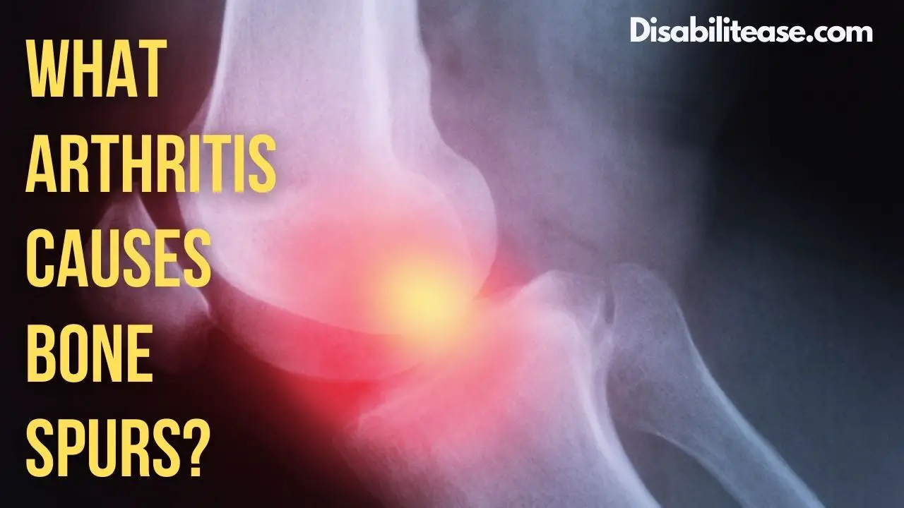 What Arthritis Causes Bone Spurs