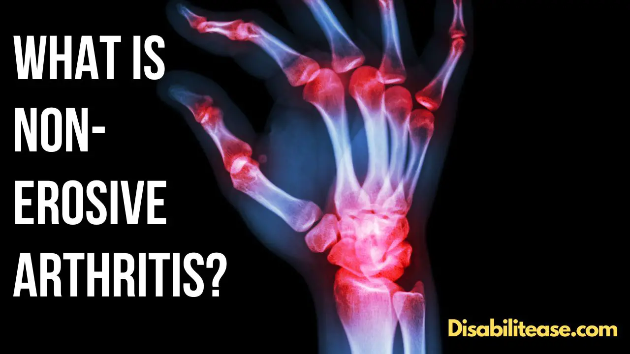 What Is Non-Erosive Arthritis